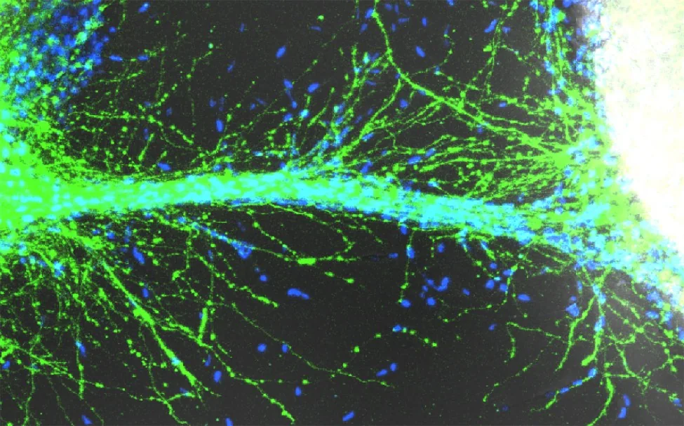 Fluorescence micrograph of nerve fibres growing along and out from a channel