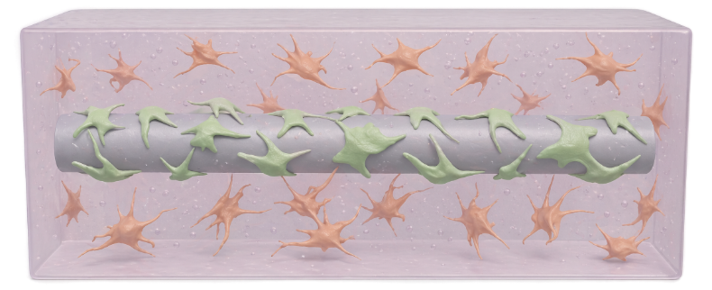 Hydrogel with cells cast around the template and crosslinked